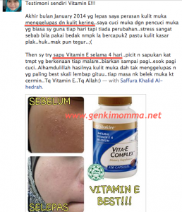 vitamin-e-masker-kulit-kering-kasar-menggelupas 