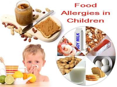 punca-eczema-anak-alahan-makanan